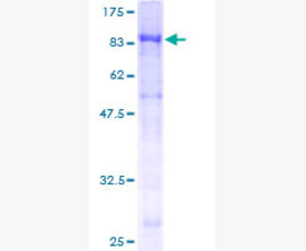Recombinant Human Fatty Acid-Binding Protein 2/FABP2/I-FABP