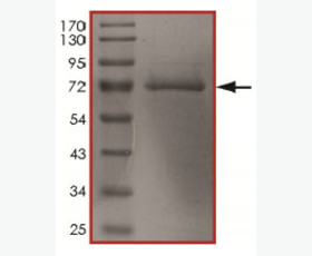 Recombinant Mouse Interleukin-22/IL-22