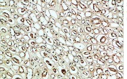 PLK2 Polyclonal Antibody