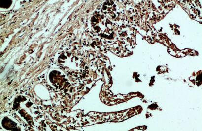 Fibronectin Polyclonal Antibody