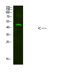 NMUR2 Polyclonal Antibody