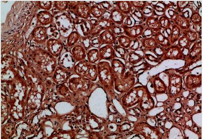EYA1/EYA4 Polyclonal Antibody