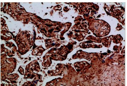 NAIP Polyclonal Antibody