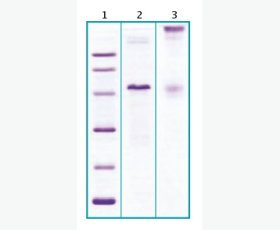 Recombinant Human C-C Motif Chemokine 28/CCL28
