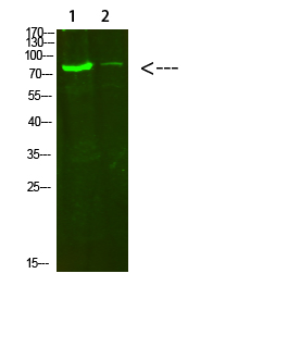 COL8A2 Polyclonal Antibody