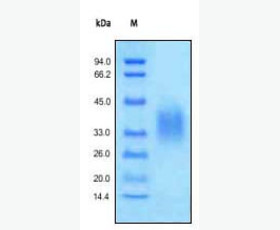 Recombinant Human SMAD Family Member 1/SMAD1