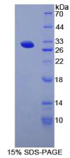 Recombinant Thyroglobulin (TG)