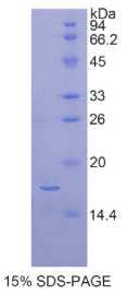 Carcinoembryonic Antigen (CEA)