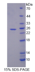 Recombinant Secreted Phosphoprotein 2 (SPP2)