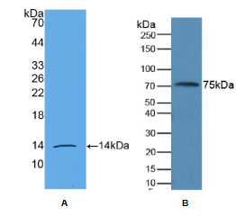 Monoclonal Antibody to Anti Mullerian Hormone (AMH)