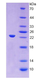 Recombinant Alpha-1-Acid Glycoprotein (a1AGP)