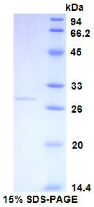 Recombinant C Reactive Protein (CRP)