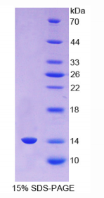 Recombinant Angiogenic Factor With G Patch And FHA Domains 1 (AGGF1)