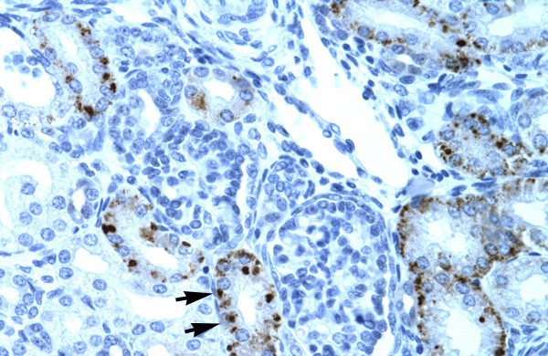 TCFL5 antibody
