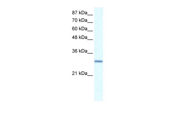 GTF2E2 antibody
