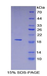 Recombinant Thrombomodulin (TM)