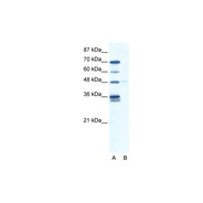GLIS2 antibody