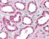 IKBKG Antibody