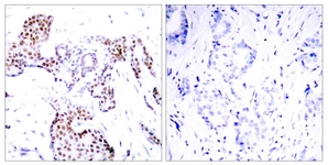 Elk1 (Phospho-Ser389)antibody