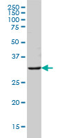 MS4A1 Antibody (monoclonal) (M01)