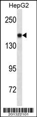 NCAM1 Antibody (Ascites)
