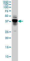 NDRG4 Antibody (monoclonal) (M01)