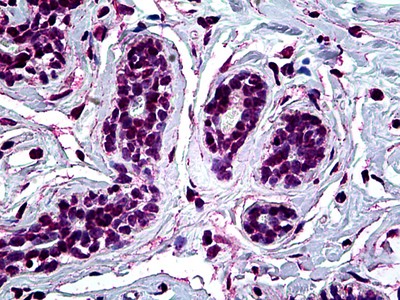 RUNX1 Antibody