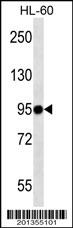 MMP9 Antibody (Ascites)