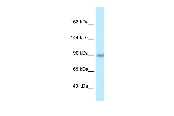 TBC1D2B antibody - C-terminal region