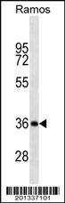 MS4A1/CD20 Antibody (C-term) (Ascites)