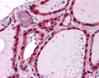 IRAK Antibody