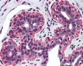 TP73 Antibody