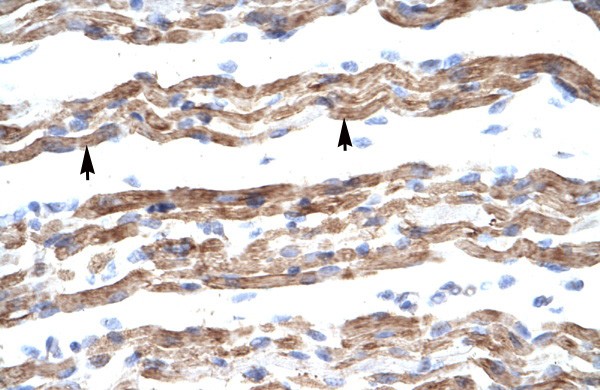PQBP1 antibody