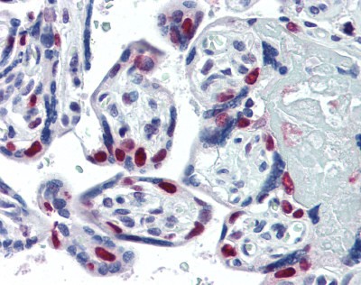 PARP1 Antibody