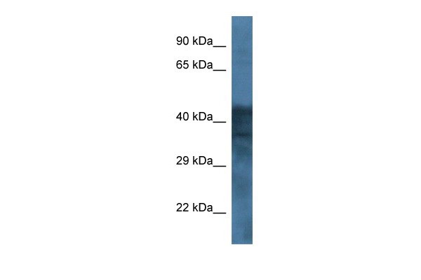 GABRB1 antibody - middle region