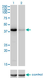 NEIL2 Antibody (monoclonal) (M01)