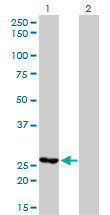 MTHFD2 Antibody (monoclonal) (M01)