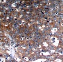 IGF 1R Antibody