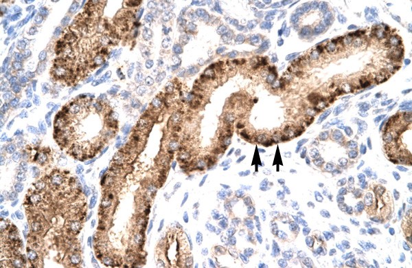 NR5A1 antibody