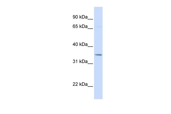TOLLIP antibody - C-terminal region