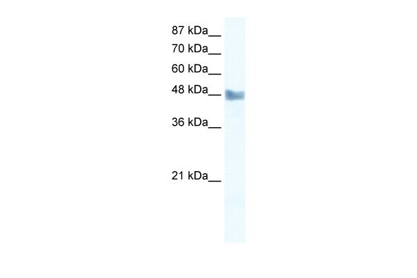 MAP3K8 antibody