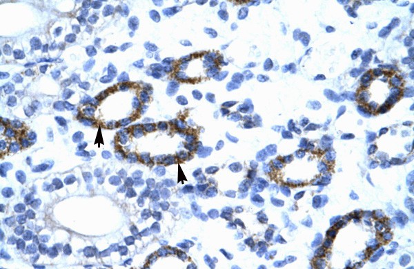 GTF2F2 antibody