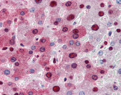 NPM1 Antibody