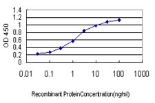 MTHFR Antibody (monoclonal) (M01)