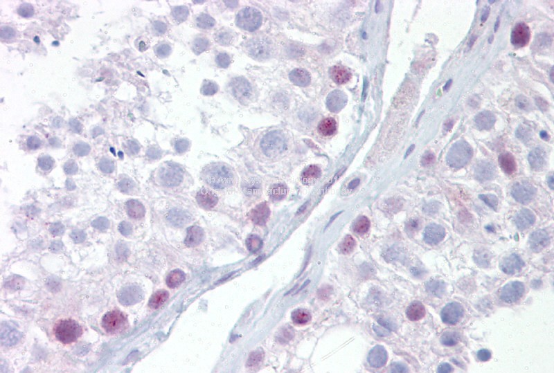 UTF1 antibody