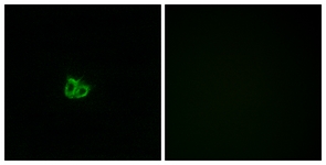 Stathmin 1 (Phospho-Ser15) antibody