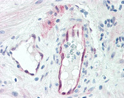 MAPK3 Antibody