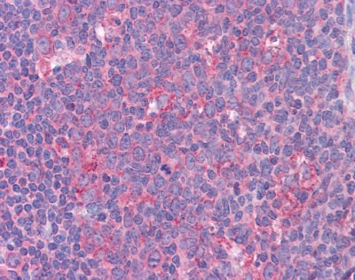 STAT6 antibody - C-terminal region