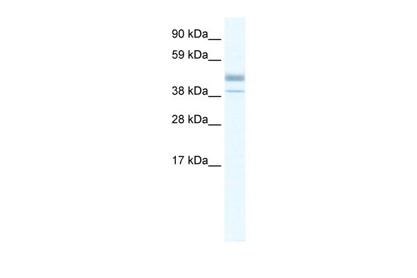 ESRRB antibody - N-terminal region