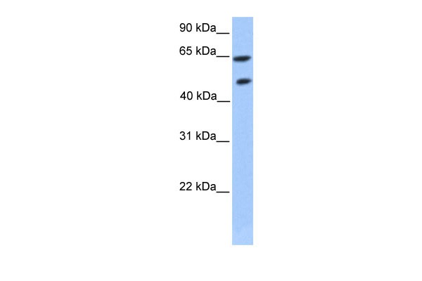 ZNF449 antibody - middle region